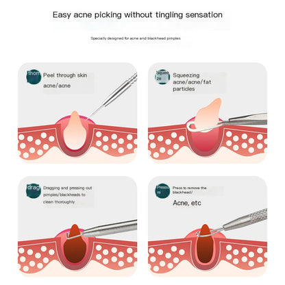 Pimple Extraction Tool Set for Beauty Salons
