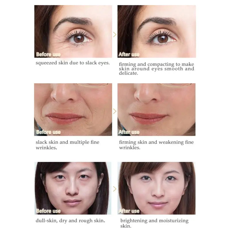 ARTISCARE Peptide Anti Wrinkle Facial Cream + Golden Eye Cream Anti-Wrinkle Anti-Aging Skin Care Whitening and Lifting Day Cream