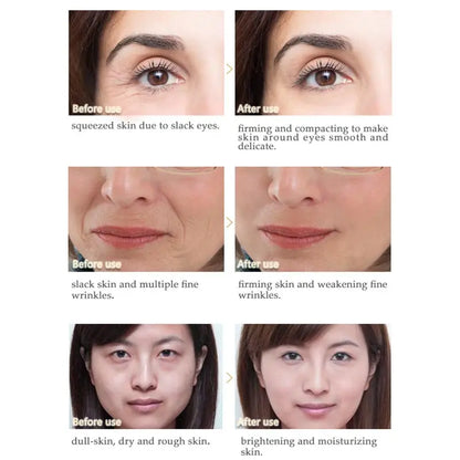 ARTISCARE Peptide Anti Wrinkle Facial Cream + Golden Eye Cream Anti-Wrinkle Anti-Aging Skin Care Whitening and Lifting Day Cream