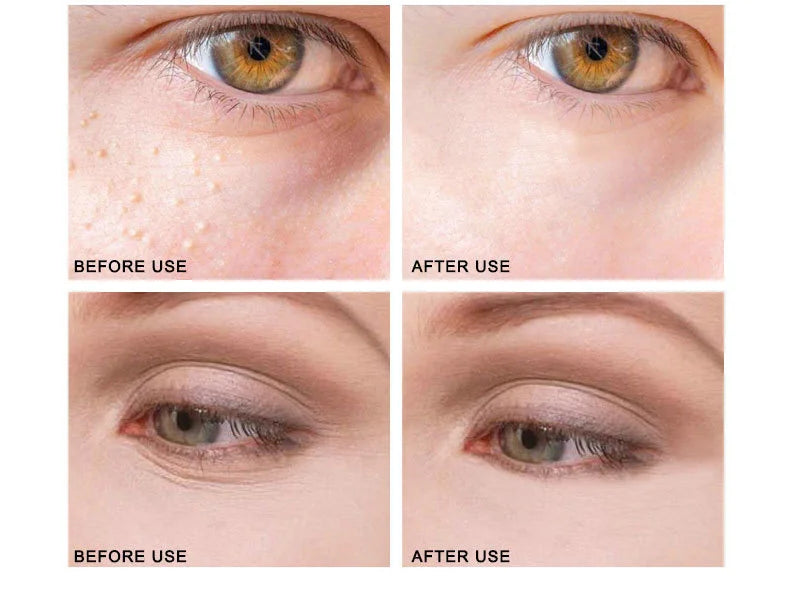 ARTISCARE Peptide Anti Wrinkle Facial Cream + Golden Eye Cream Anti-Wrinkle Anti-Aging Skin Care Whitening and Lifting Day Cream