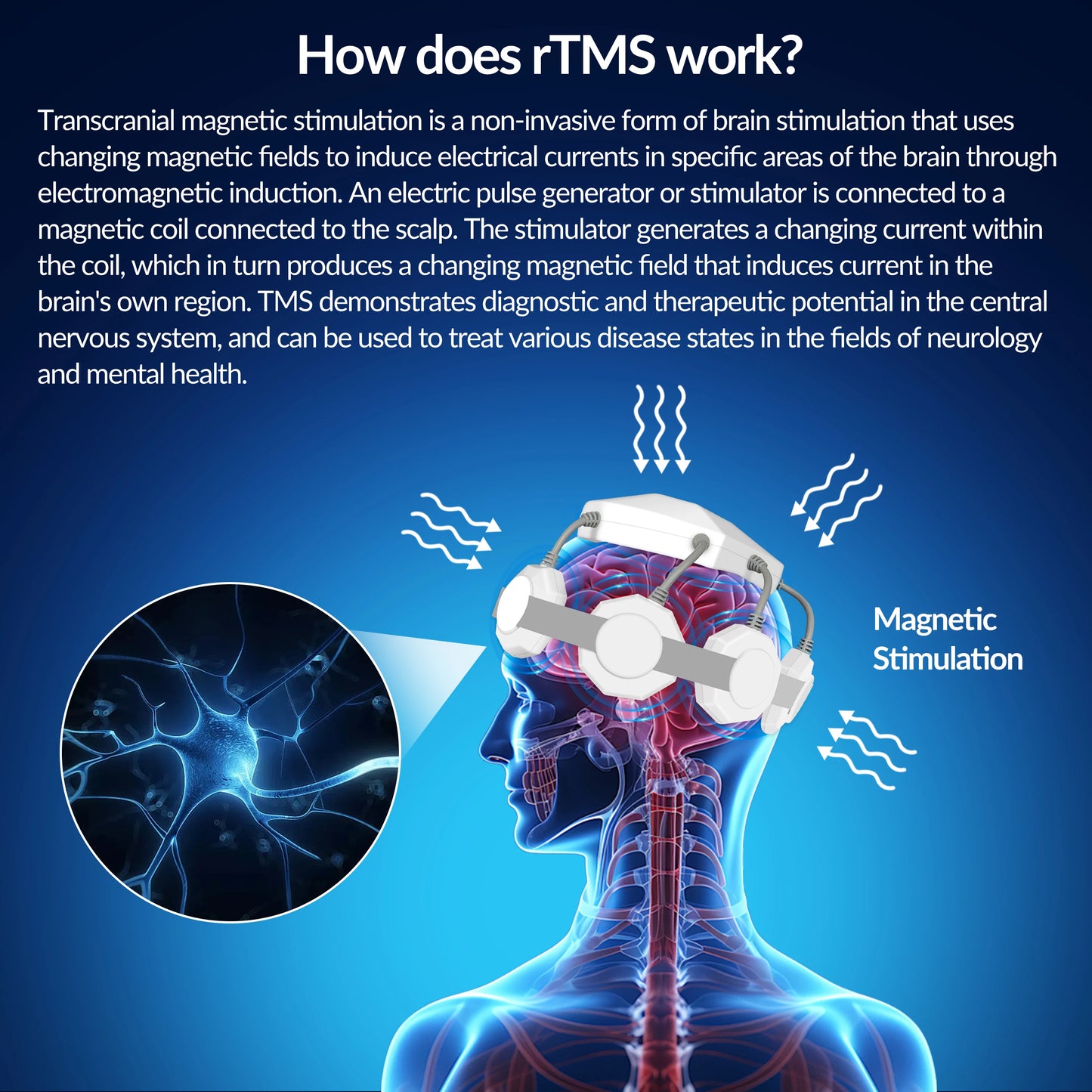 Best Gift Transcranial Magnetic Stimulator for Brain Health RTMS Therapy for Chronic Fatigue & Migraine Neuro Recovery Equipment