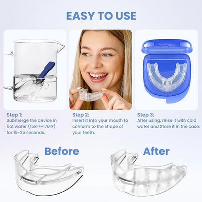 Teeth Bruxism Sleeping Apnea Guard Anti Snoring Bruxism Mouth Guard Snoring Device Bruxismo Snoring Mouth Guard to Stop Snoring
