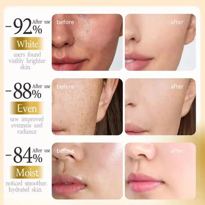 PDRN Face Cream Salmon DNA Skin Regeneration Anti Wrinkle Lifting Firming Whitening Brightening Moisturizer Korean Skin Care 20g