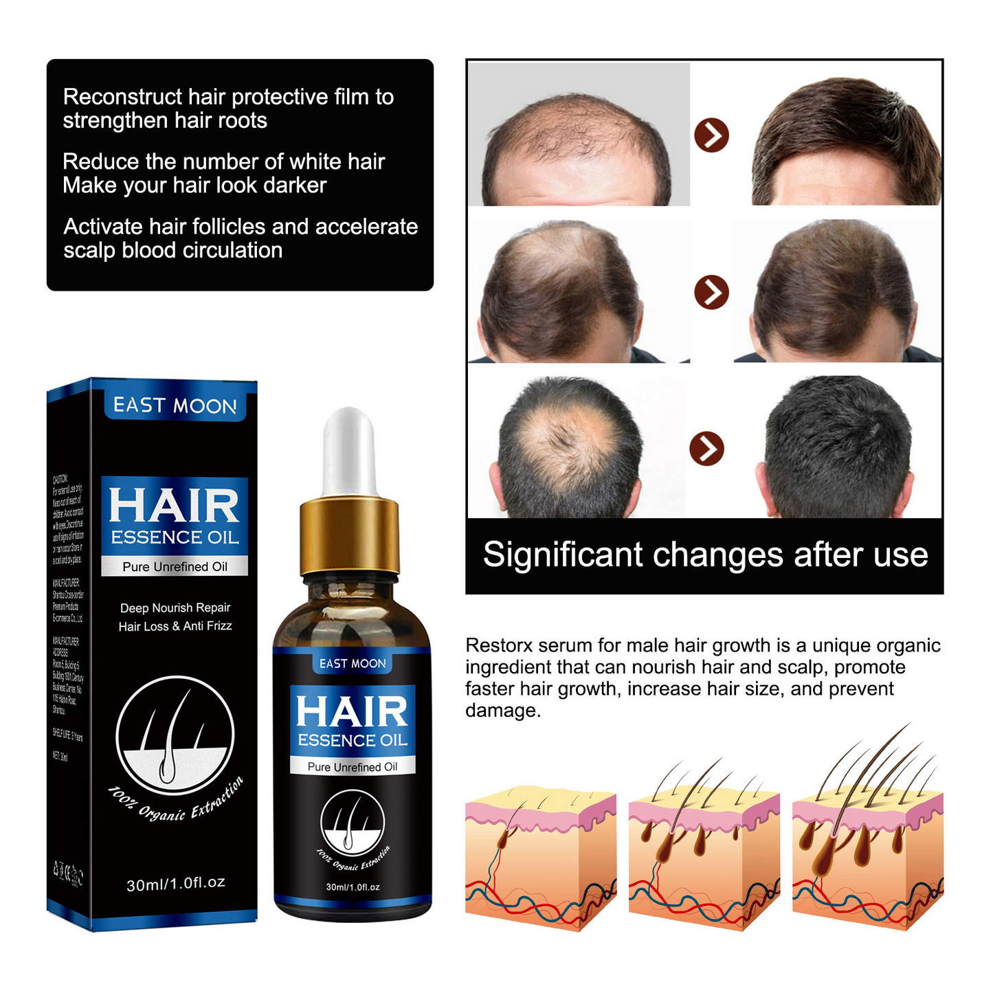 East Moon Men's Dense Hair Essence Strong Nutrition
